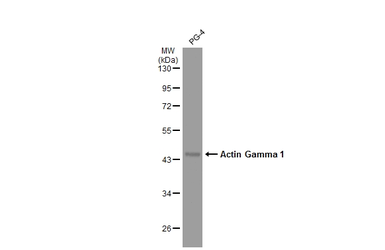 Anti-Actin Gamma 1 antibody used in Western Blot (WB). GTX101794
