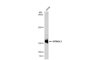 Anti-EPB41L3 antibody [C3], C-term used in Western Blot (WB). GTX101805