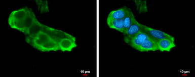 Anti-RPL5 antibody used in Immunocytochemistry/ Immunofluorescence (ICC/IF). GTX101821