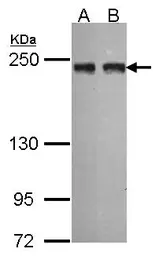 Anti-MIA3 antibody [N1], N-term used in Western Blot (WB). GTX101827