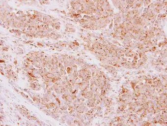 Anti-NDUFS5 antibody used in IHC (Paraffin sections) (IHC-P). GTX101829