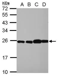 Anti-RPL29 antibody used in Western Blot (WB). GTX101833