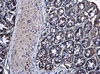 Anti-RPS10 antibody used in IHC (Paraffin sections) (IHC-P). GTX101836