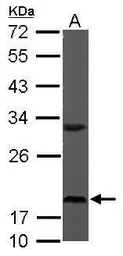 Anti-RPS10 antibody used in Western Blot (WB). GTX101836