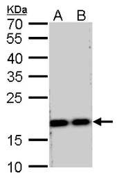 Anti-RPS15 antibody used in Western Blot (WB). GTX101839