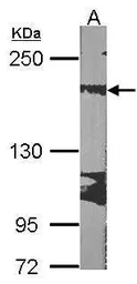 Anti-Ribosome binding protein 1 antibody [C3], C-term used in Western Blot (WB). GTX101844