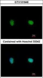 Anti-Ku70 antibody [N1N3] used in Immunocytochemistry/ Immunofluorescence (ICC/IF). GTX101848