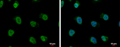 Anti-hnRNP AB antibody used in Immunocytochemistry/ Immunofluorescence (ICC/IF). GTX101852