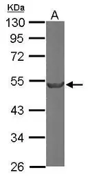 Anti-beta Tubulin 2 antibody [N1C1] used in Western Blot (WB). GTX101863
