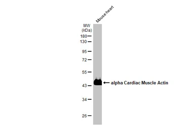 Anti-alpha Cardiac Muscle Actin antibody used in Western Blot (WB). GTX101876