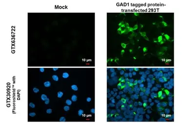 Anti-GAD67 antibody used in Immunocytochemistry/ Immunofluorescence (ICC/IF). GTX101881