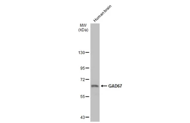 Anti-GAD67 antibody used in Western Blot (WB). GTX101881