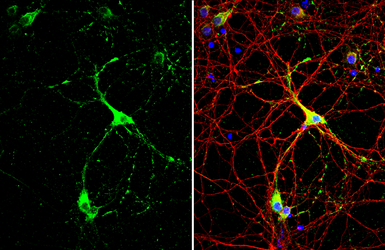 Anti-GAD67 antibody used in Immunocytochemistry/ Immunofluorescence (ICC/IF). GTX101881