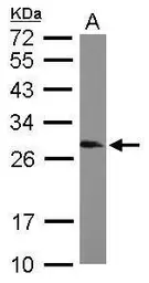 Anti-SNRPB antibody used in Western Blot (WB). GTX101883