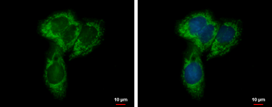 Anti-UQCRC1 antibody used in Immunocytochemistry/ Immunofluorescence (ICC/IF). GTX101896