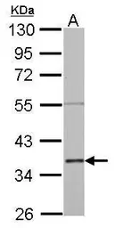 Anti-Annexin II antibody used in Western Blot (WB). GTX101902