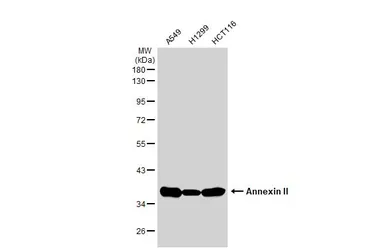 Anti-Annexin II antibody used in Western Blot (WB). GTX101902