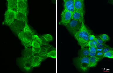 Anti-Annexin II antibody used in Immunocytochemistry/ Immunofluorescence (ICC/IF). GTX101902
