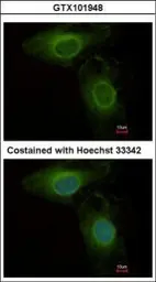 Anti-PHGDH antibody [N1N2], N-term used in Immunocytochemistry/ Immunofluorescence (ICC/IF). GTX101948