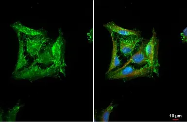 Anti-HAX1 antibody used in Immunocytochemistry/ Immunofluorescence (ICC/IF). GTX101992