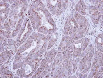 Anti-HAX1 antibody used in IHC (Paraffin sections) (IHC-P). GTX101992