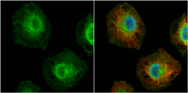 Anti-MCL1 antibody used in Immunocytochemistry/ Immunofluorescence (ICC/IF). GTX102026