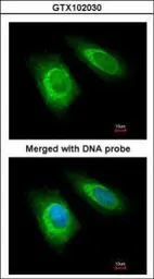 Anti-ZNHIT1 antibody [N1C3] used in Immunocytochemistry/ Immunofluorescence (ICC/IF). GTX102030