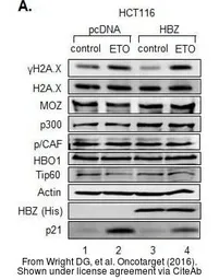 Anti-MYST2 antibody [N2C1], Internal used in Western Blot (WB). GTX102041