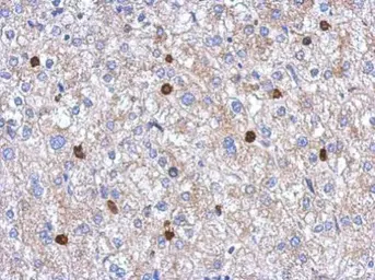 Anti-MYST2 antibody [N2C1], Internal used in IHC (Paraffin sections) (IHC-P). GTX102041