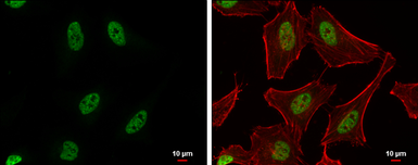 Anti-PUF60 antibody used in Immunocytochemistry/ Immunofluorescence (ICC/IF). GTX102051