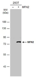 Anti-MFN2 antibody [N1N2], N-term used in Western Blot (WB). GTX102055