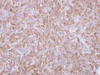 Anti-Profilin 1 antibody [N1C3] used in IHC (Paraffin sections) (IHC-P). GTX102072