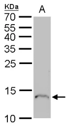 Anti-Profilin 1 antibody [N1C3] used in Western Blot (WB). GTX102072