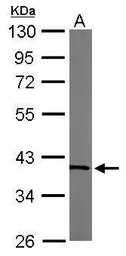 Anti-Transaldolase antibody used in Western Blot (WB). GTX102076