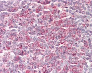 Anti-MRPL23 antibody [N1C3] used in IHC (Paraffin sections) (IHC-P). GTX102094