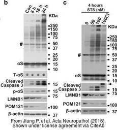 Anti-POM121 antibody [N2N3] used in Western Blot (WB). GTX102128