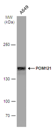 Anti-POM121 antibody [N2N3] used in Western Blot (WB). GTX102128
