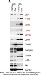 Anti-Cofilin 1 antibody used in Western Blot (WB). GTX102156