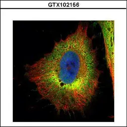 Anti-Cofilin 1 antibody used in Immunocytochemistry/ Immunofluorescence (ICC/IF). GTX102156