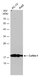 Anti-Cofilin 1 antibody used in Western Blot (WB). GTX102156