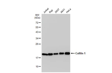 Anti-Cofilin 1 antibody used in Western Blot (WB). GTX102156