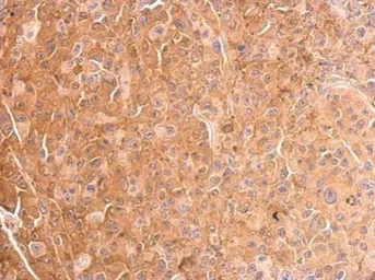 Anti-Cofilin 1 antibody used in IHC (Paraffin sections) (IHC-P). GTX102156