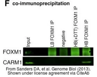 Anti-FOXM1 antibody used in Immunoprecipitation (IP). GTX102170