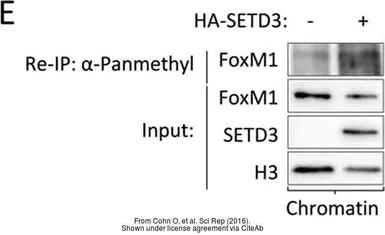 Anti-FOXM1 antibody used in Western Blot and Immunoprecipitation (WB IP). GTX102170