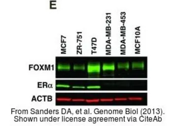 Anti-FOXM1 antibody used in Western Blot (WB). GTX102170