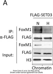 Anti-FOXM1 antibody used in Western Blot (WB). GTX102170