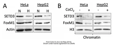 Anti-FOXM1 antibody used in Western Blot (WB). GTX102170