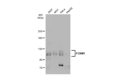 Anti-FOXM1 antibody used in Western Blot (WB). GTX102170