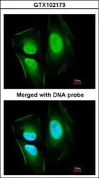 Anti-KIAA0494 antibody [N3C3] used in Immunocytochemistry/ Immunofluorescence (ICC/IF). GTX102173