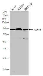 Anti-PAF49 antibody used in Western Blot (WB). GTX102175